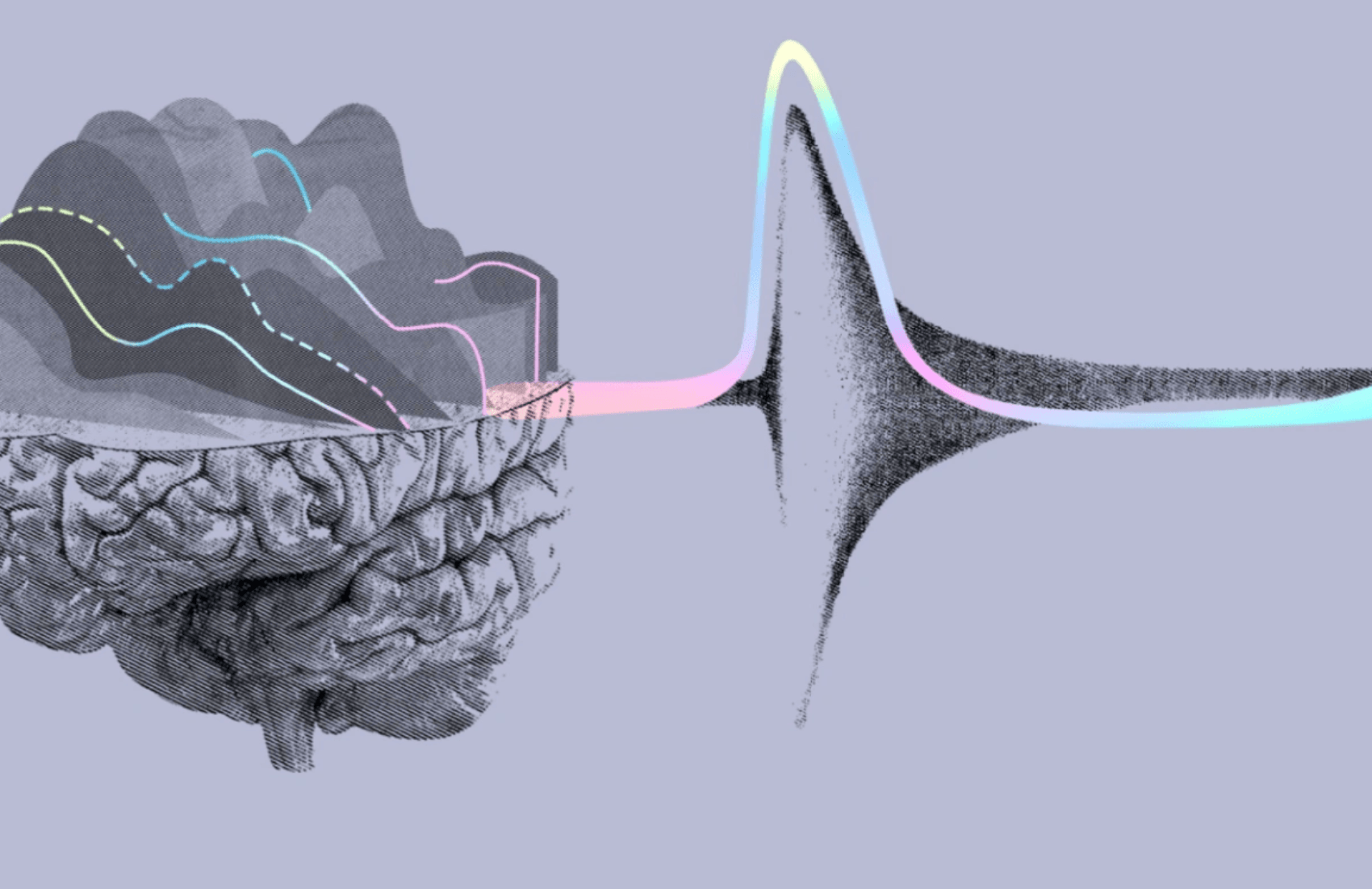 Neuralink saņem apstiprinājumu smadzeņu čipa izmēģinājumiem ar cilvēkiem